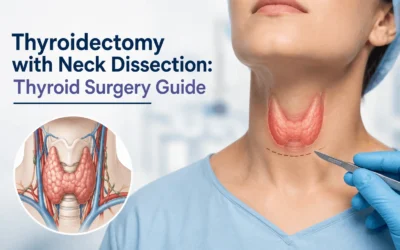 Thyroidectomy with Neck Dissection: Thyroid Surgery Guide