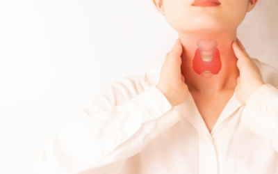 Papillary Thyroid Cancer Recurrence After Total Thyroidectomy