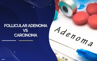 Follicular Adenoma Vs Carcinoma