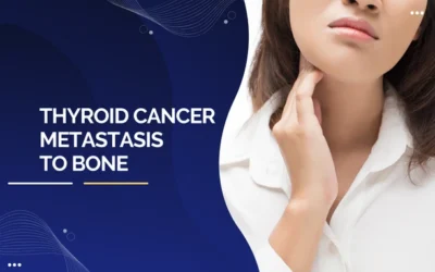 Thyroid Cancer Metastasis To Bone