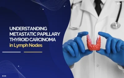 Understanding Metastatic Papillary Thyroid Carcinoma in Lymph Nodes