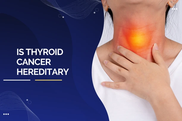 Is Thyroid Cancer Hereditary?