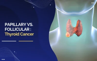 Papillary vs. Follicular Thyroid Cancer: What’s the Difference?