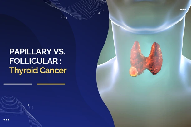 Papillary vs. Follicular Thyroid Cancer: What’s the Difference?