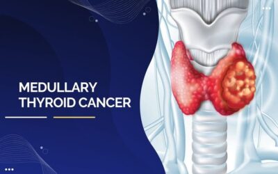 Medullary Thyroid Cancer
