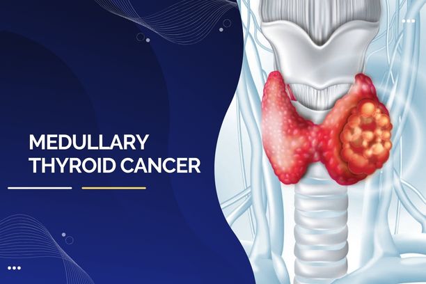 Medullary Thyroid Cancer