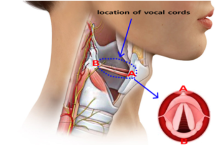 Will My Voice Change After RABIT Surgery- Dr sandeep nayak